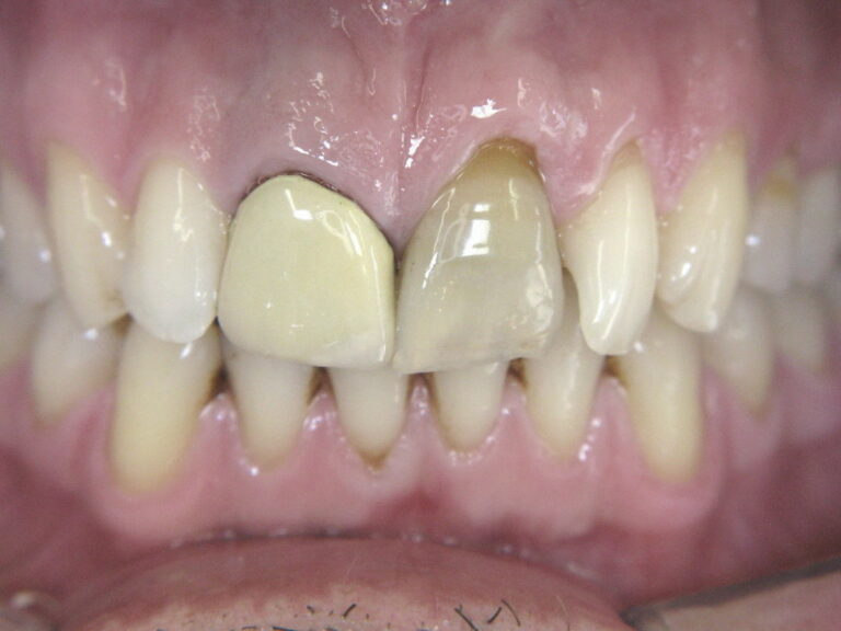 VorherNachher Zahnarztpraxis Dr. Zehnle